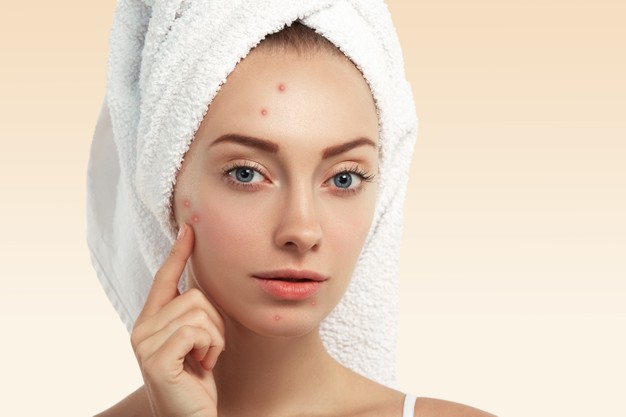 como tratar a acne